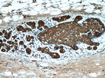 PKLR Antibody in Immunohistochemistry (Paraffin) (IHC (P))