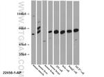 PKLR Antibody in Western Blot (WB)