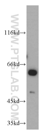 PKLR Antibody in Western Blot (WB)