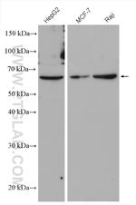 PKLR Antibody in Western Blot (WB)