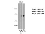 PKLR Antibody in Western Blot (WB)