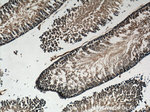 GNRHR Antibody in Immunohistochemistry (Paraffin) (IHC (P))