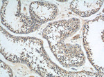 GNRHR Antibody in Immunohistochemistry (Paraffin) (IHC (P))