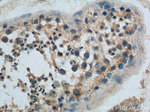 GNRHR Antibody in Immunohistochemistry (Paraffin) (IHC (P))