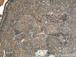 GNRHR Antibody in Immunohistochemistry (Paraffin) (IHC (P))