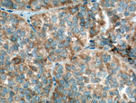 GNRHR Antibody in Immunohistochemistry (Paraffin) (IHC (P))