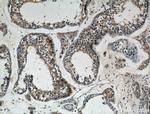 GNRHR Antibody in Immunohistochemistry (Paraffin) (IHC (P))