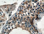 GNRHR Antibody in Immunohistochemistry (Paraffin) (IHC (P))