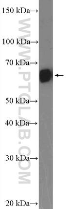 GNRHR Antibody in Western Blot (WB)