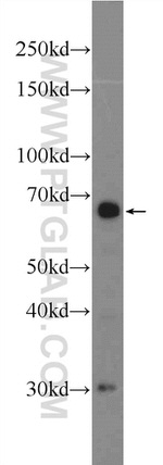 FOXA2 Antibody in Western Blot (WB)