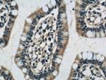 CNOT9 Antibody in Immunohistochemistry (Paraffin) (IHC (P))