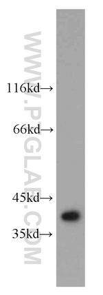 CNOT9 Antibody in Western Blot (WB)