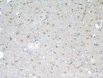 EAAT2 Antibody in Immunohistochemistry (Paraffin) (IHC (P))