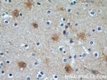 EAAT2 Antibody in Immunohistochemistry (Paraffin) (IHC (P))