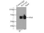 EAAT2 Antibody in Immunoprecipitation (IP)