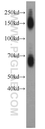 EAAT2 Antibody in Western Blot (WB)