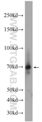 AIRE Antibody in Western Blot (WB)