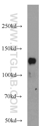 SRGAP2 Antibody in Western Blot (WB)