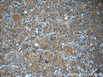 HPGDS Antibody in Immunohistochemistry (Paraffin) (IHC (P))