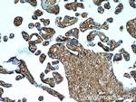 HPGDS Antibody in Immunohistochemistry (Paraffin) (IHC (P))