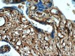 HPGDS Antibody in Immunohistochemistry (Paraffin) (IHC (P))