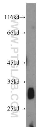 HPGDS Antibody in Western Blot (WB)