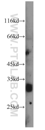 HPGDS Antibody in Western Blot (WB)