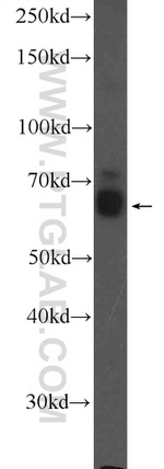 DAT Antibody in Western Blot (WB)