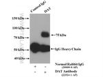 DAT Antibody in Western Blot (WB)