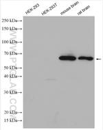 DAT Antibody in Western Blot (WB)