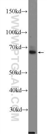 DAT Antibody in Western Blot (WB)