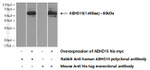 ABHD15 Antibody in Western Blot (WB)