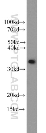 WDR61 Antibody in Western Blot (WB)