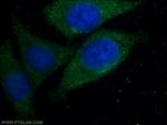 GAB2 Antibody in Immunocytochemistry (ICC/IF)