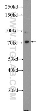 GAB2 Antibody in Western Blot (WB)