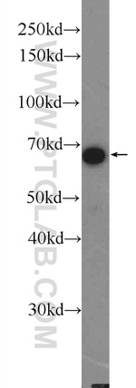 GAB2 Antibody in Western Blot (WB)