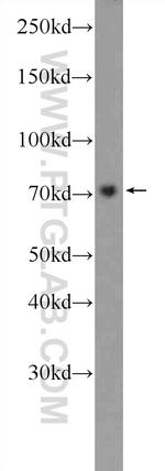 GAB2 Antibody in Western Blot (WB)