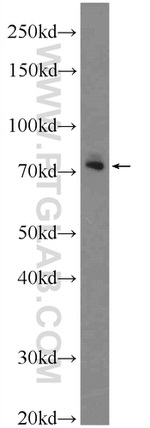 GAB2 Antibody in Western Blot (WB)