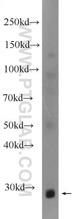 FTSJ2 Antibody in Western Blot (WB)