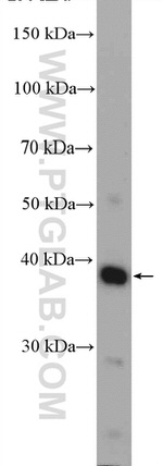 C4orf49 Antibody in Western Blot (WB)