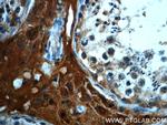 C4orf49 Antibody in Immunohistochemistry (Paraffin) (IHC (P))