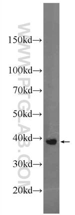 C4orf49 Antibody in Western Blot (WB)