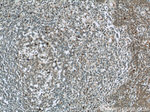 RNASEL Antibody in Immunohistochemistry (Paraffin) (IHC (P))