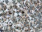 RNASEL Antibody in Immunohistochemistry (Paraffin) (IHC (P))