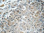 RNASEL Antibody in Immunohistochemistry (Paraffin) (IHC (P))