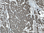 TFAM Antibody in Immunohistochemistry (Paraffin) (IHC (P))