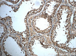 TFAM Antibody in Immunohistochemistry (Paraffin) (IHC (P))