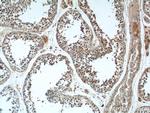 WBP2NL Antibody in Immunohistochemistry (Paraffin) (IHC (P))