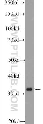 WBP2NL Antibody in Western Blot (WB)