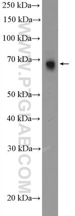 KDM4D Antibody in Western Blot (WB)